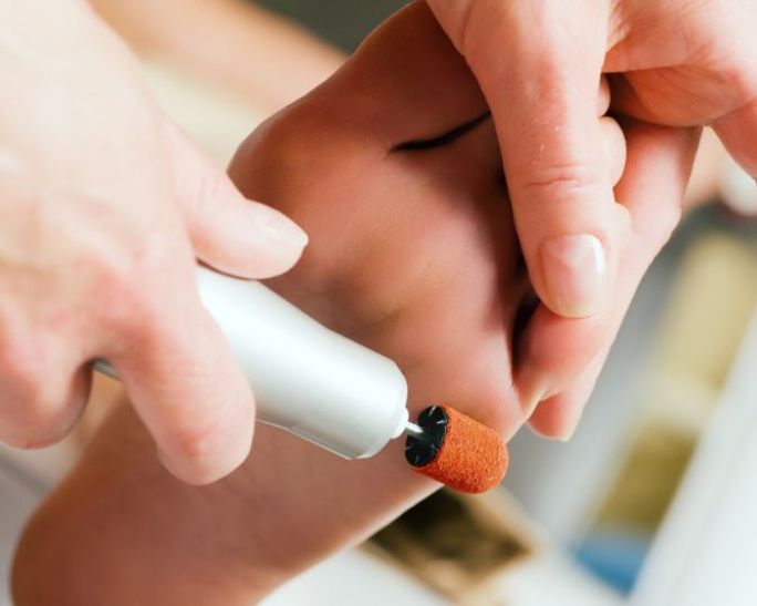 Pflege mit Elektrischer Hornhautentferner an Fußsohle